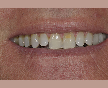 Before treatment