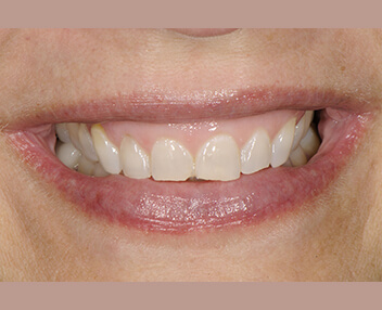 Before treatment